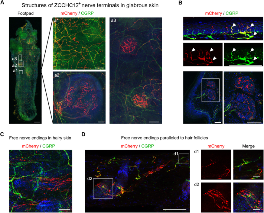 Laboratory of somatosensory development and diseases systematically describes th